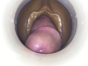 Mann